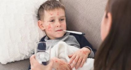 Tips para proteger a mi hijo del sarampión